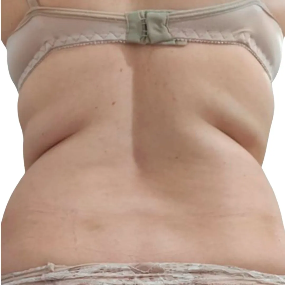 Costas-antes Costas-antes